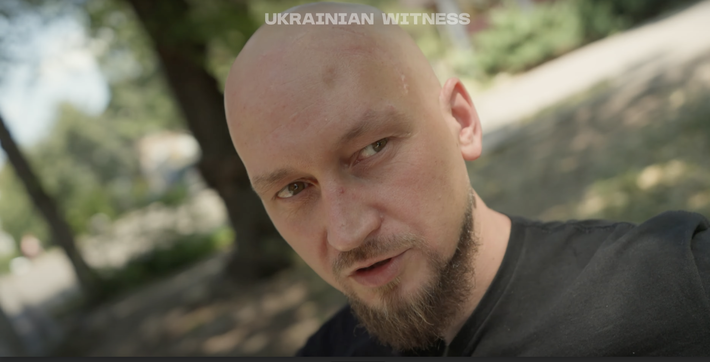 "Осколок попал в мозг": украинский музыкант рассказал о ранении на фронте